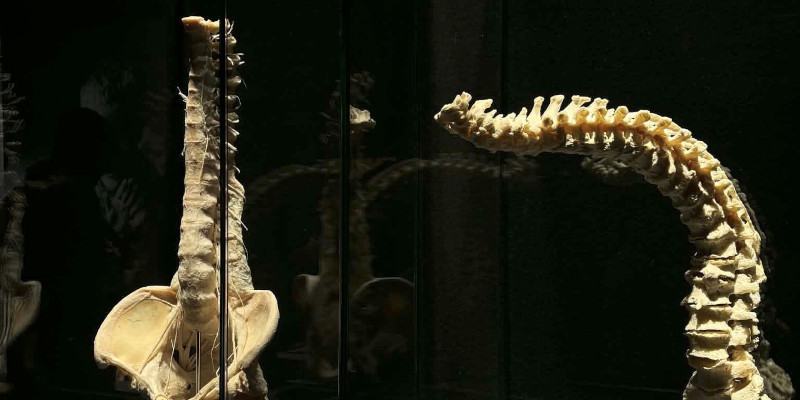  preparaty ludzkich ciał i&nbsp;narządów